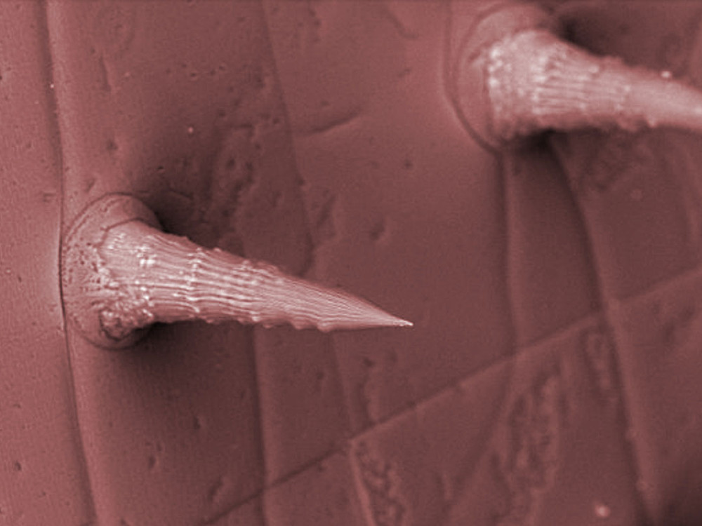 An image showing spikey submicroscopic structures.