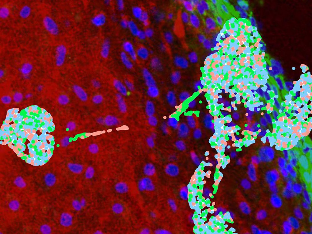 An image of cells transitioning to human cartilage.