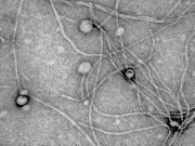 a black and white image of bacterial viruses