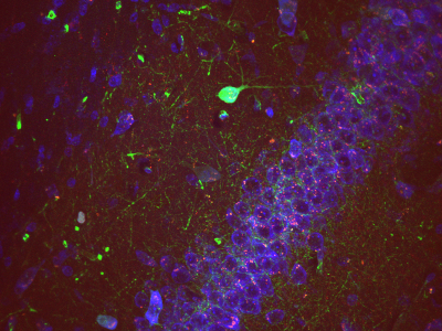 fluorescent brain slice
