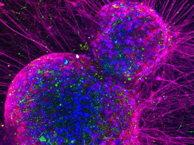 Image of a Neuron