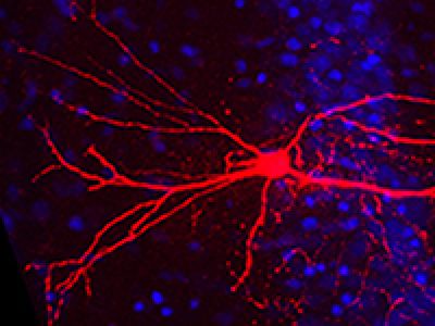 cells with fluorescent highlighting