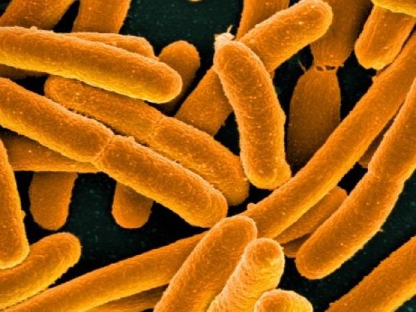 stock image of e. coli bacteria