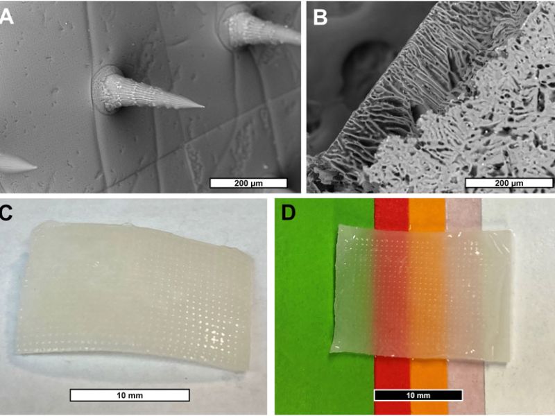 microneedle patch