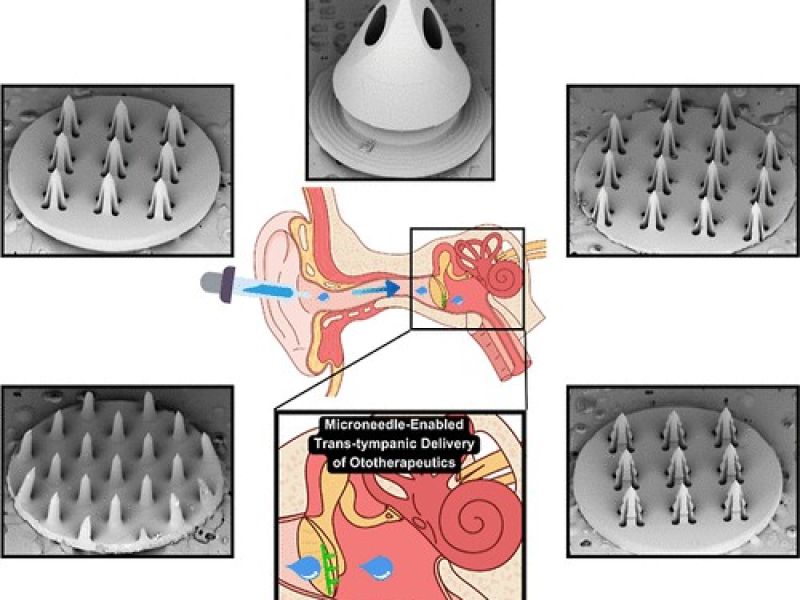 Microneedle SEM