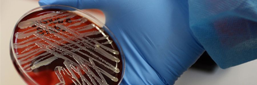 close up view of a gloved hand holding a petri dish