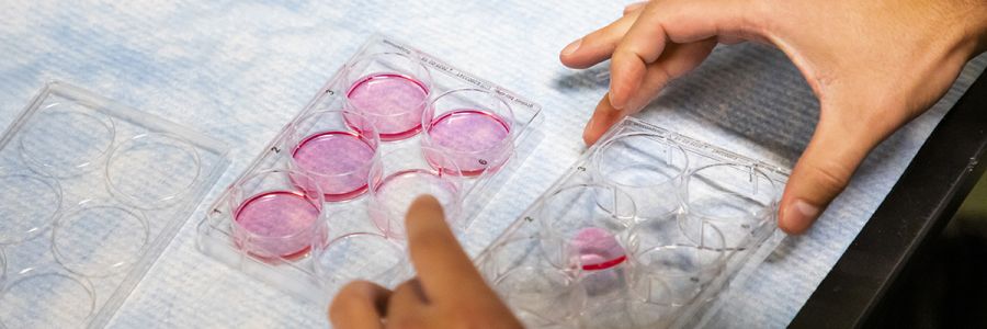 hands moving tray of 6 small circular petri dishes