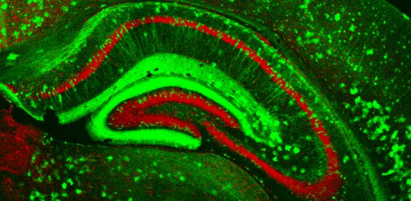 a fluorescent image of a hippocampus