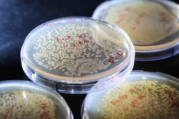 A series of petri dishes full of microbial colonies.
