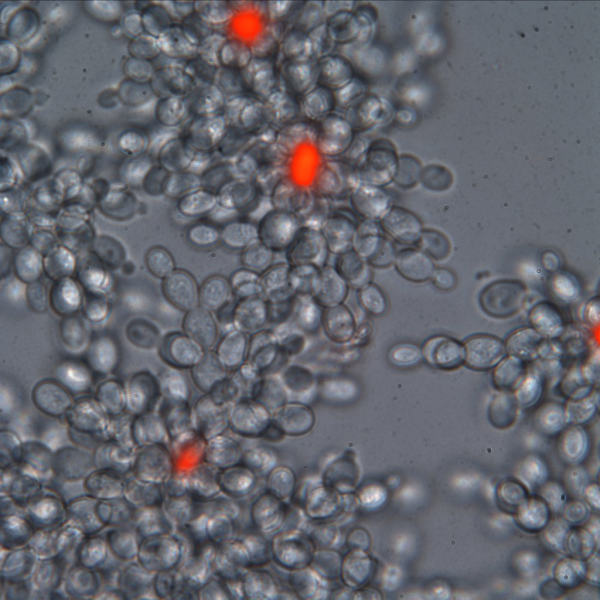 A microscope image showing mostly white and black cells, but some are highlighted in red.