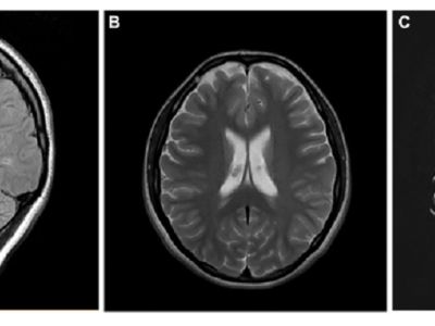 Scans of the brain